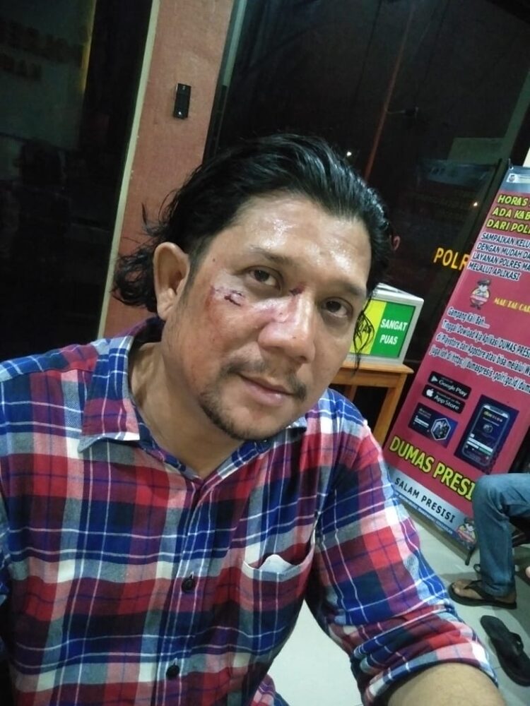 SMSI Pusat Desak Polisi Usut Kasus Penganiayaan Ketua SMSI Madina Terkait Pemberitaan